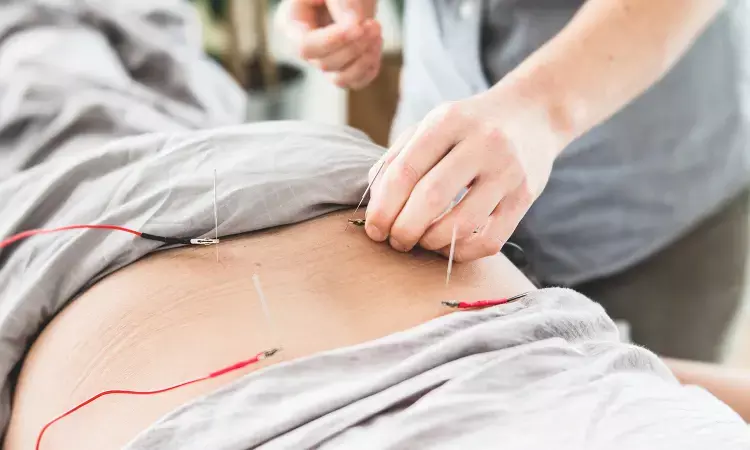 Electroacupuncture may reduce length of ileus after  Colorectal Cancer surgery: JAMA