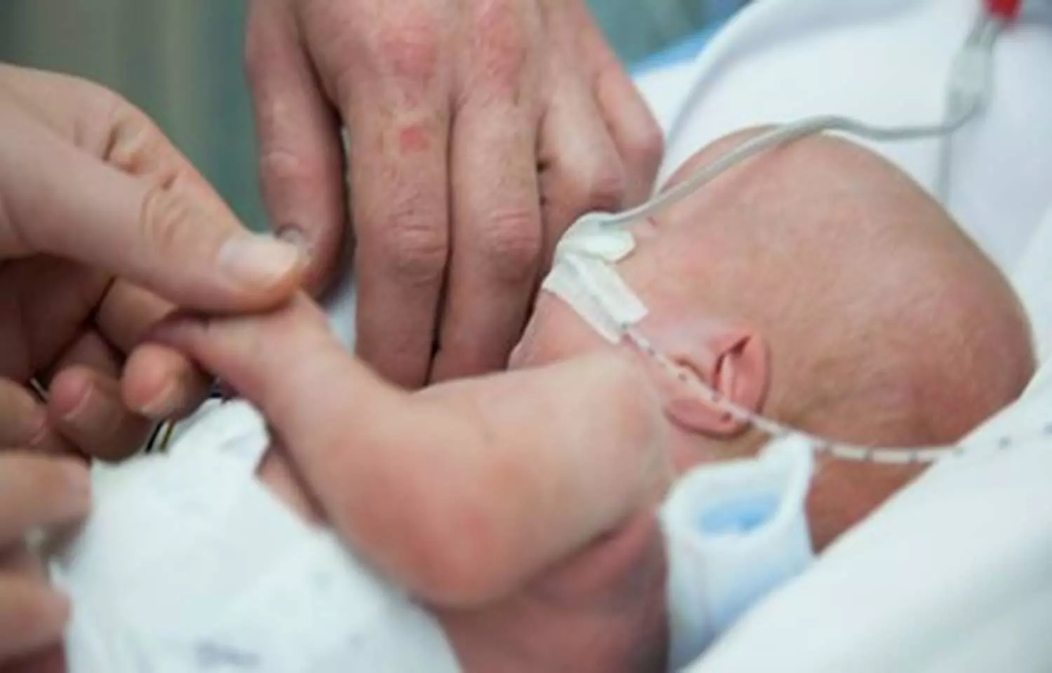 Duration of Feeding intolerance in preterm infants reduced by use of Enteral insulin