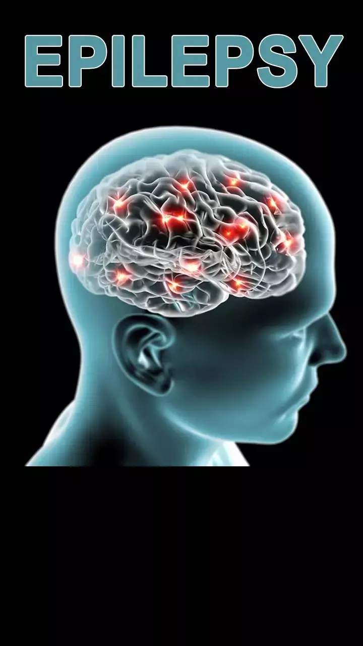 Epilepsy Awareness Day