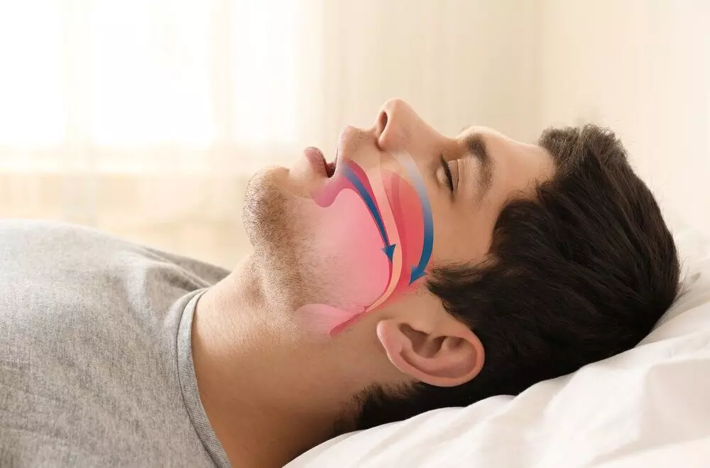 Sleep Apnea strongly linked to Visceral Adiposity in Geriatric Patients, Study finds
