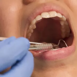 COVID-19 infection risk during dental procedures low, says study