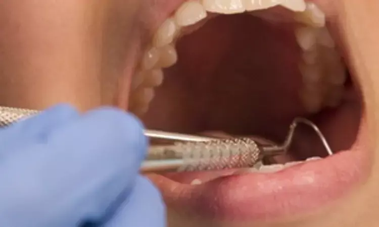 Teeth extractions on periodontal indications are questionable, Study says