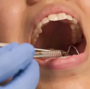 Teeth extractions on periodontal indications are questionable, Study says