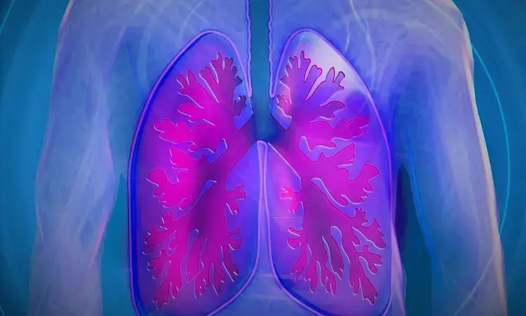 Fibrotic Lung abnormalities persist even after 1 year in severe COVID-19 survivors: Study