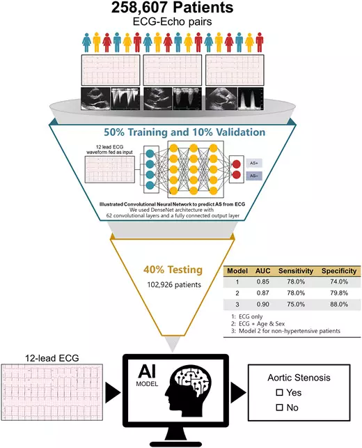 Artificial Intelligence- Enabled ECG May Help Detect Aortic Stenosis ...