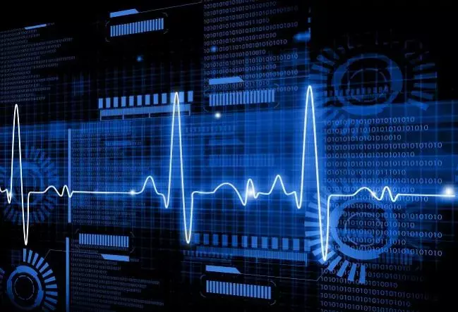 Artificial Intelligence- Enabled ECG may help Detect Aortic Stenosis, Finds Study