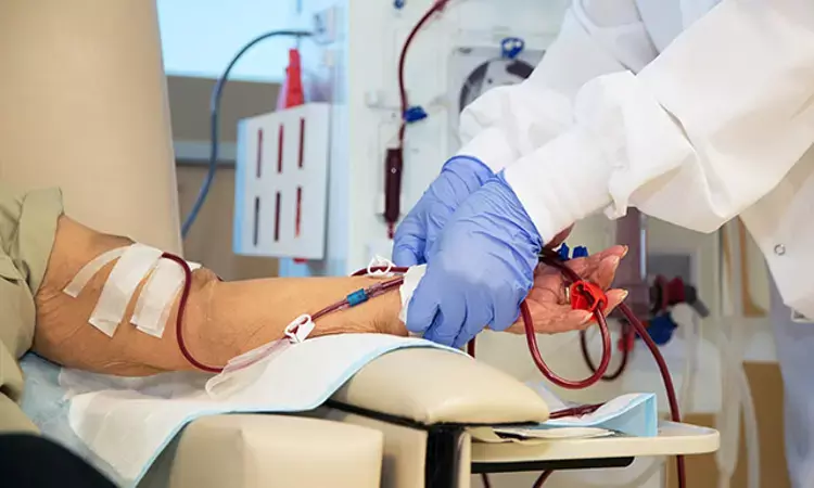 High dose hemodiafiltration may reduce mortality in kidney transplant cases: NEJM