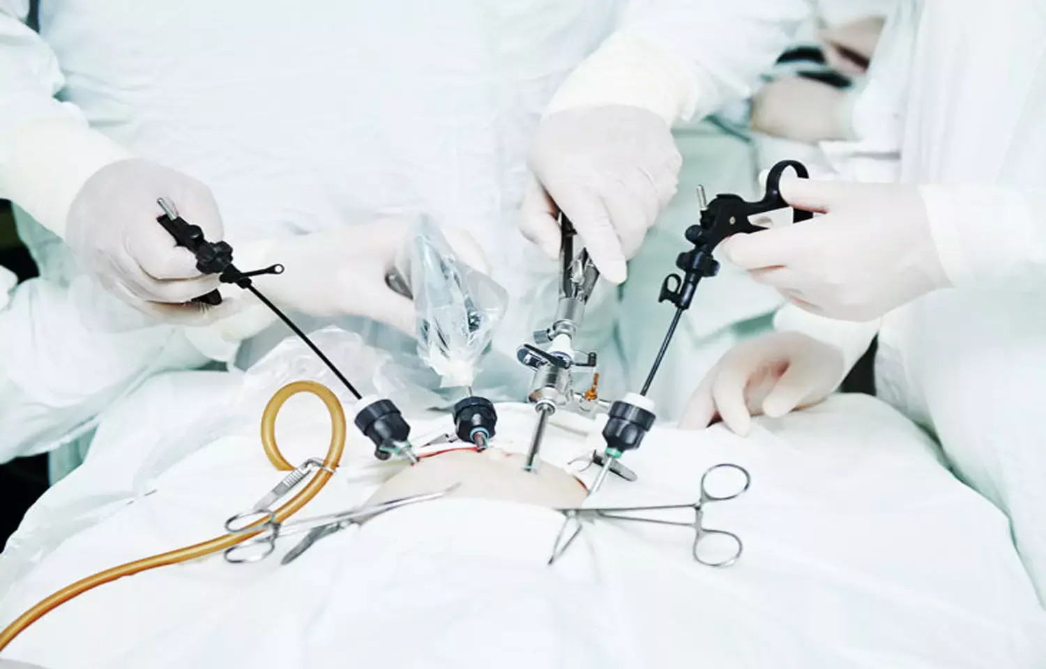 Standardized management protocols improve outcomes after emergency laparotomy