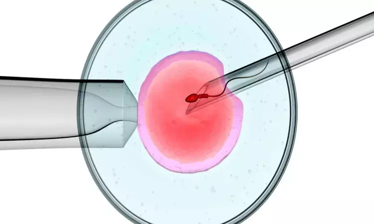 ICSI  doesnt Improve live birth rate compared to IVF if  male partners have normal sperm parameters: Lancet
