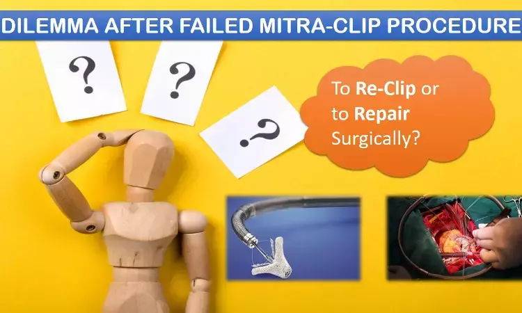 Clinicians dilemma for mitral regurgitation patients once Clipping fails, study seeks to clear the confusion.