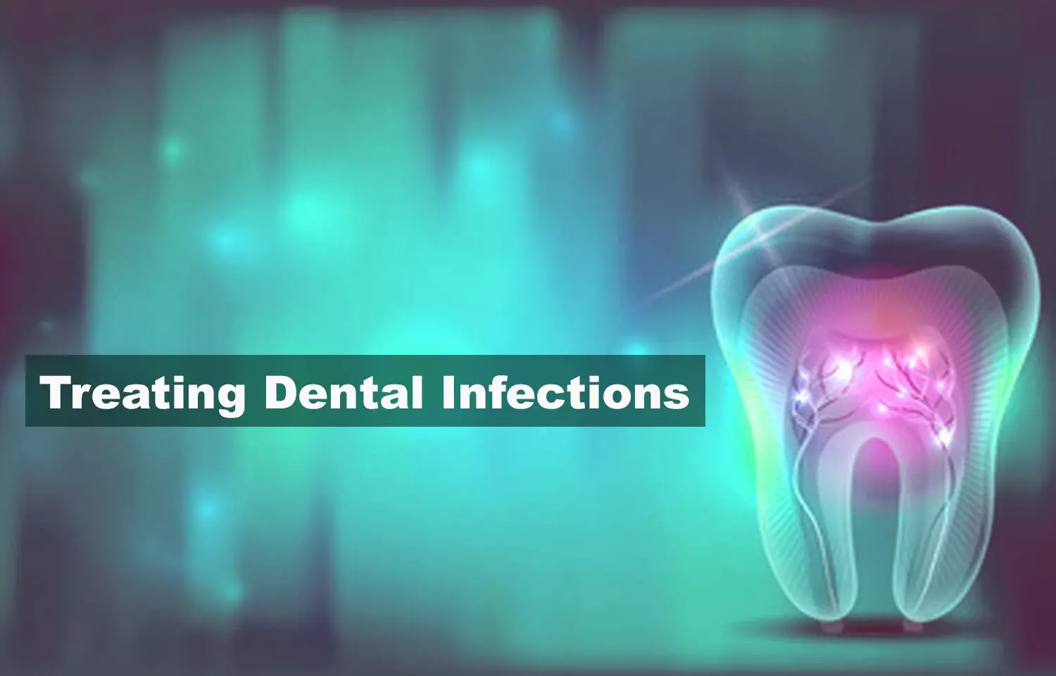 What should you consider as a first line of choice in dental infections?