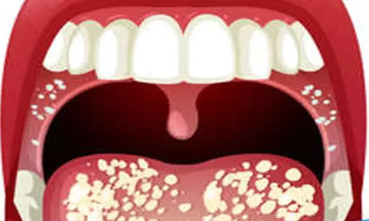 Elevated mean platelet volume in red oral lichen may indicate ...
