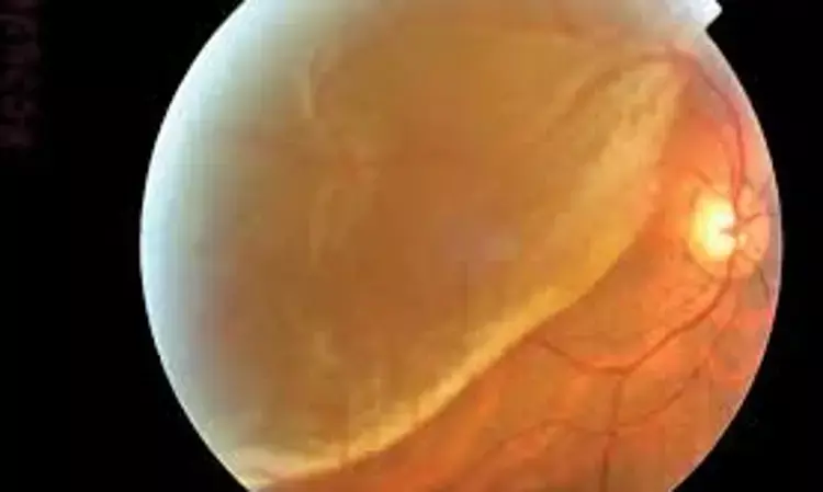 Malignant hypertension unveiling as Bilateral exudative retinal detachment- BMJ Case Report