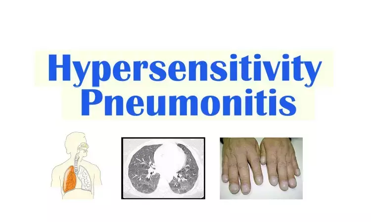 Diagnosis and management of hypersensitivity pneumonitis: Chest guidelines