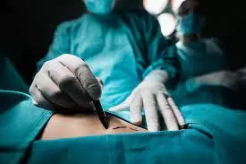 Wound complications frequency similar in different incisions of cesarean surgery in morbidly obese women
