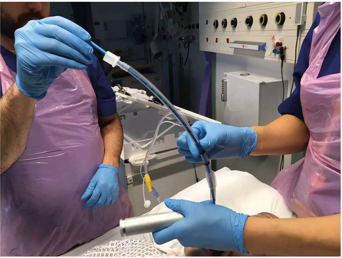 Tracheal Intubation With Stylet Have High First Pass Intubation Success Rate