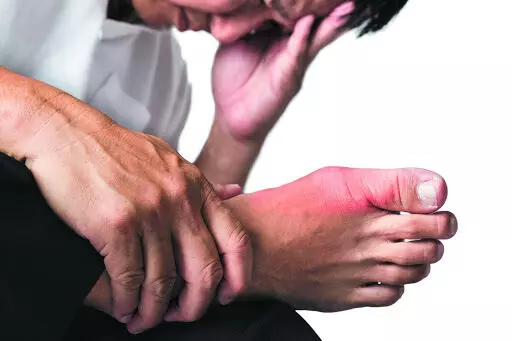 Ultrasound findings may predict risk of future gout flares