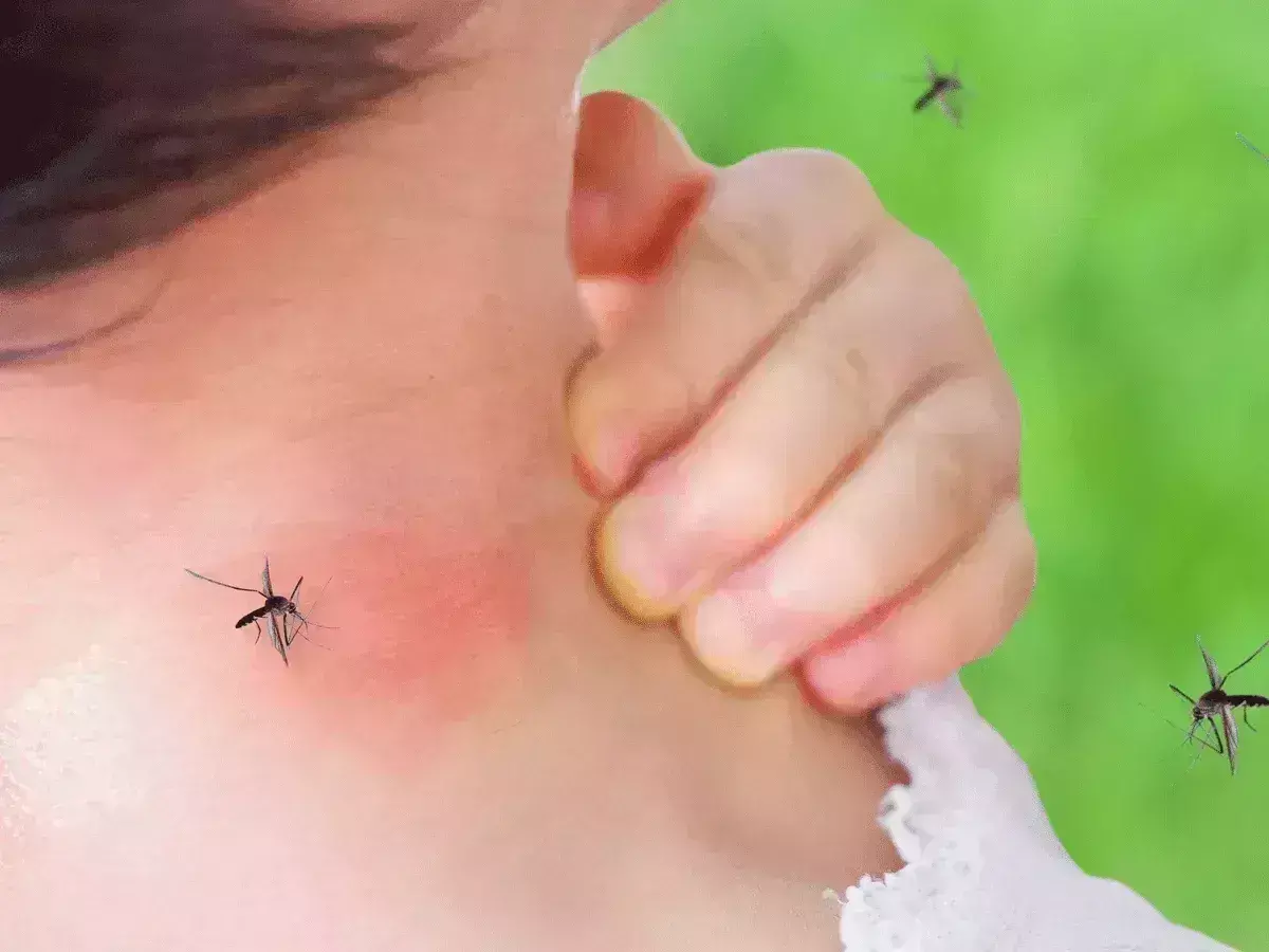 Study Discovers Promising Novel Method to Control Dengue: NEJM