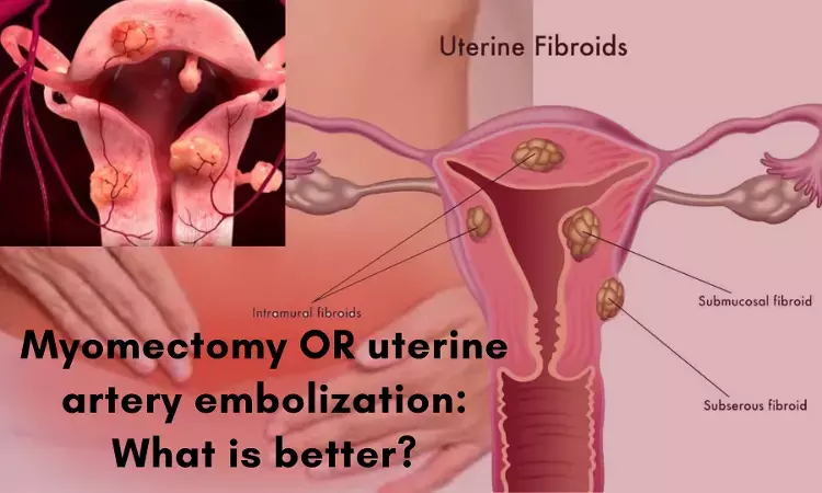 Myomectomy yields superior health-related quality of life to uterine artery embolization: FEMME trial