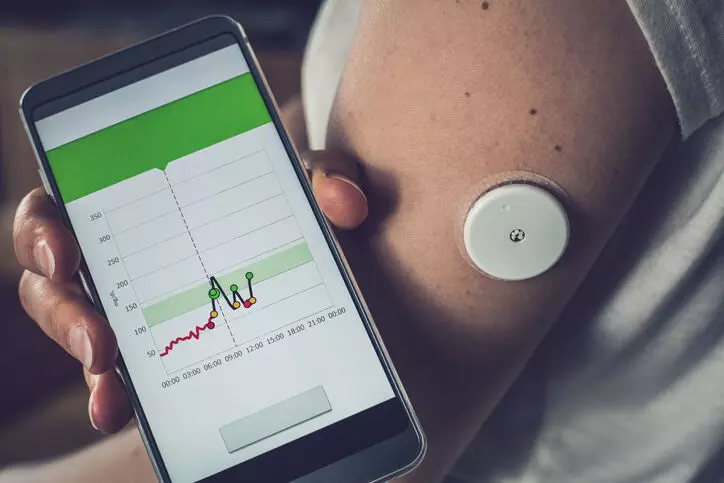 Flash Glucose Monitoring Improves blood sugar control in diabetes, Finds Study