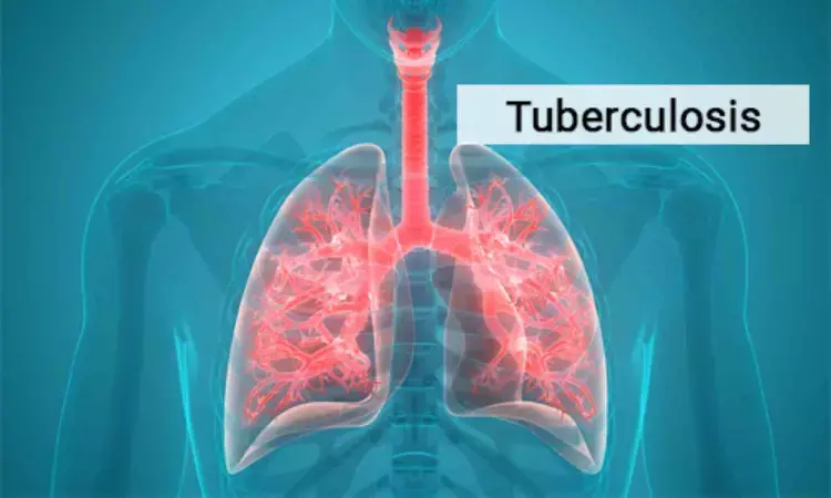 Lung cancer risk increases after tuberculosis episode: Study
