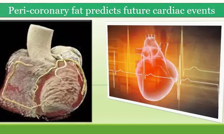 Peri-coronary fat may be a game-changer in cardiovascular risk prediction: JACC study
