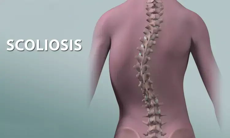 Drug combination reduces narcotic use, manages pain after surgery for teens with scoliosis