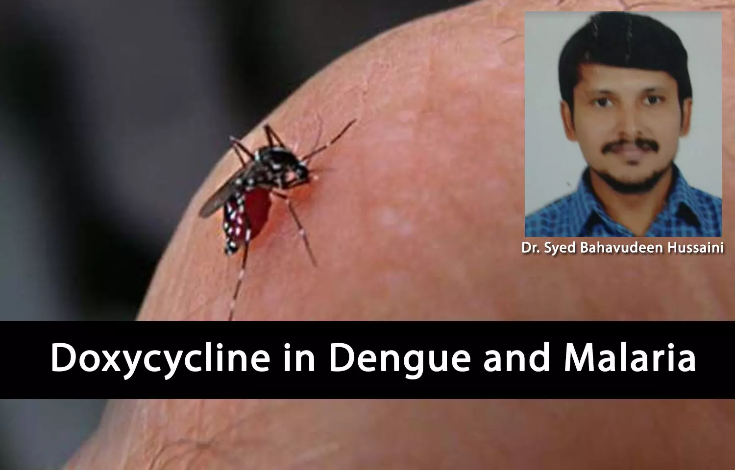 Improving Clinical Outcomes with the Use of Doxycycline in Dengue and Malaria - An Indian Experience