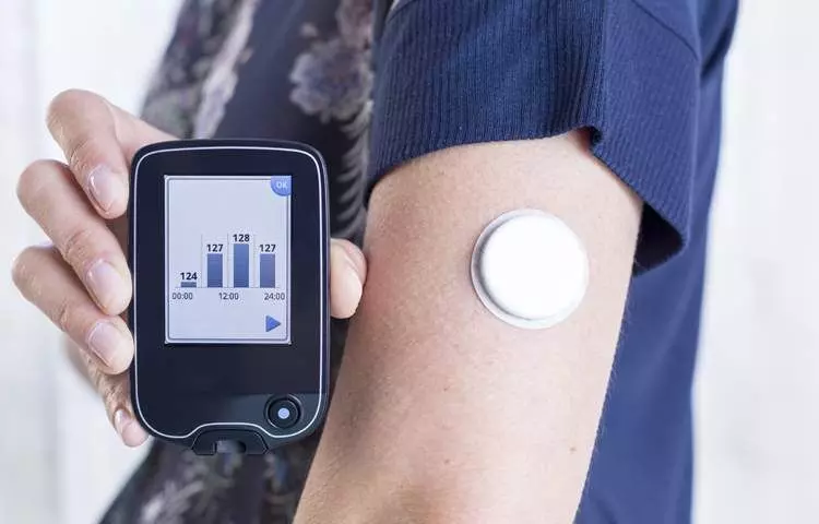 CGM bests traditional self-test method for controlling blood sugar in type 1 diabetes patients