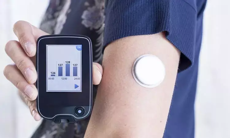 CGM bests traditional self-test method for controlling blood sugar in type 1 diabetes patients