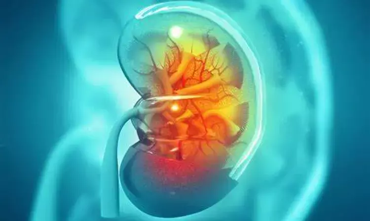 Chronic Kidney Disease More Common In Cancer Patients: Study