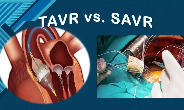 NOTION verdict out: TAVR comparable to SAVR even after 8 years, EHJ