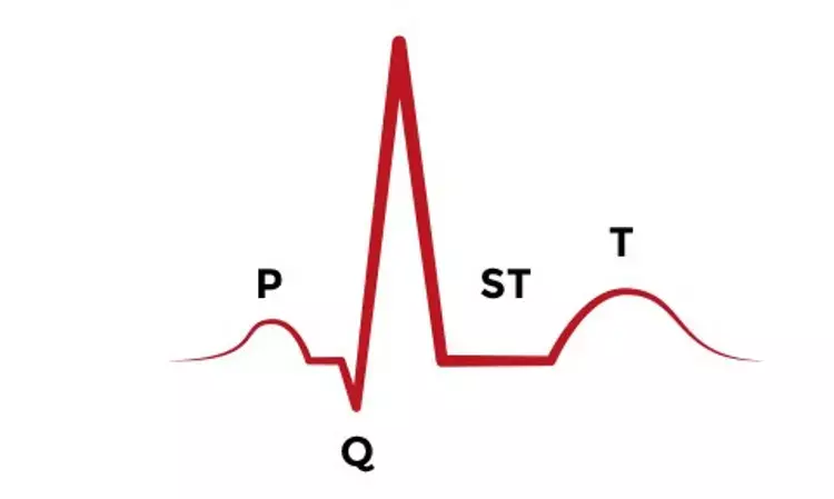 Handheld ECG for Measurement of QTc interval Receives FDA Clearance