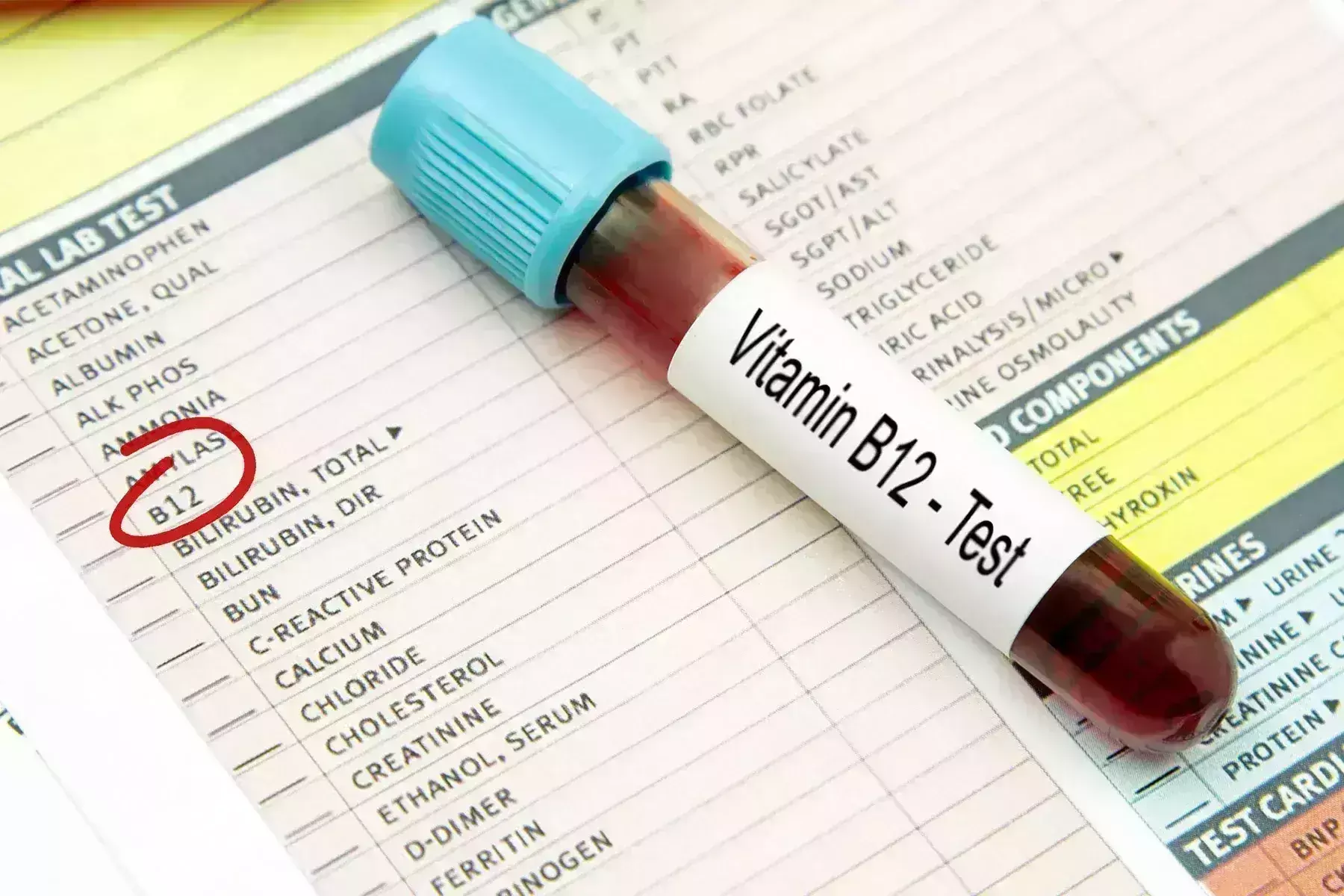 Vitamin B12 deficiency tied to  increased risk of depressive symptoms in community-dwelling