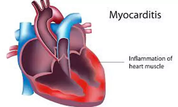 Benefits of COVID-19 vaccination outweigh risks of rare cases of myocarditis: Study