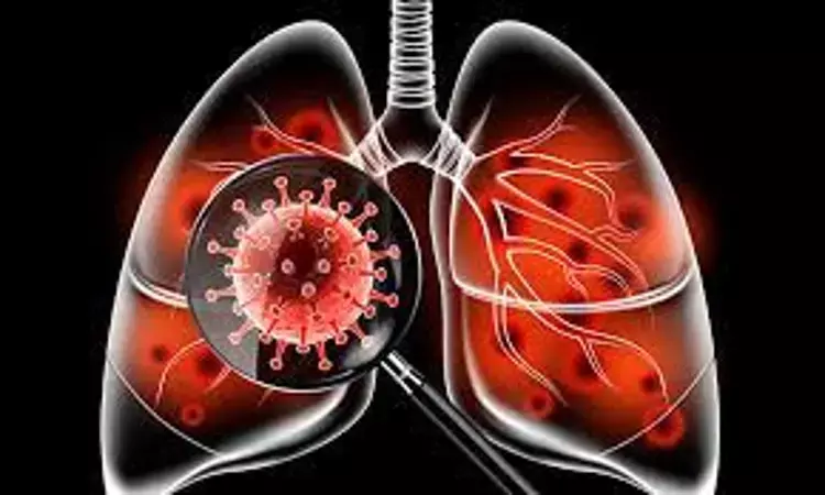 Routine respiratory followup important in recovered COVID-19 pneumonia  patients: Lancet