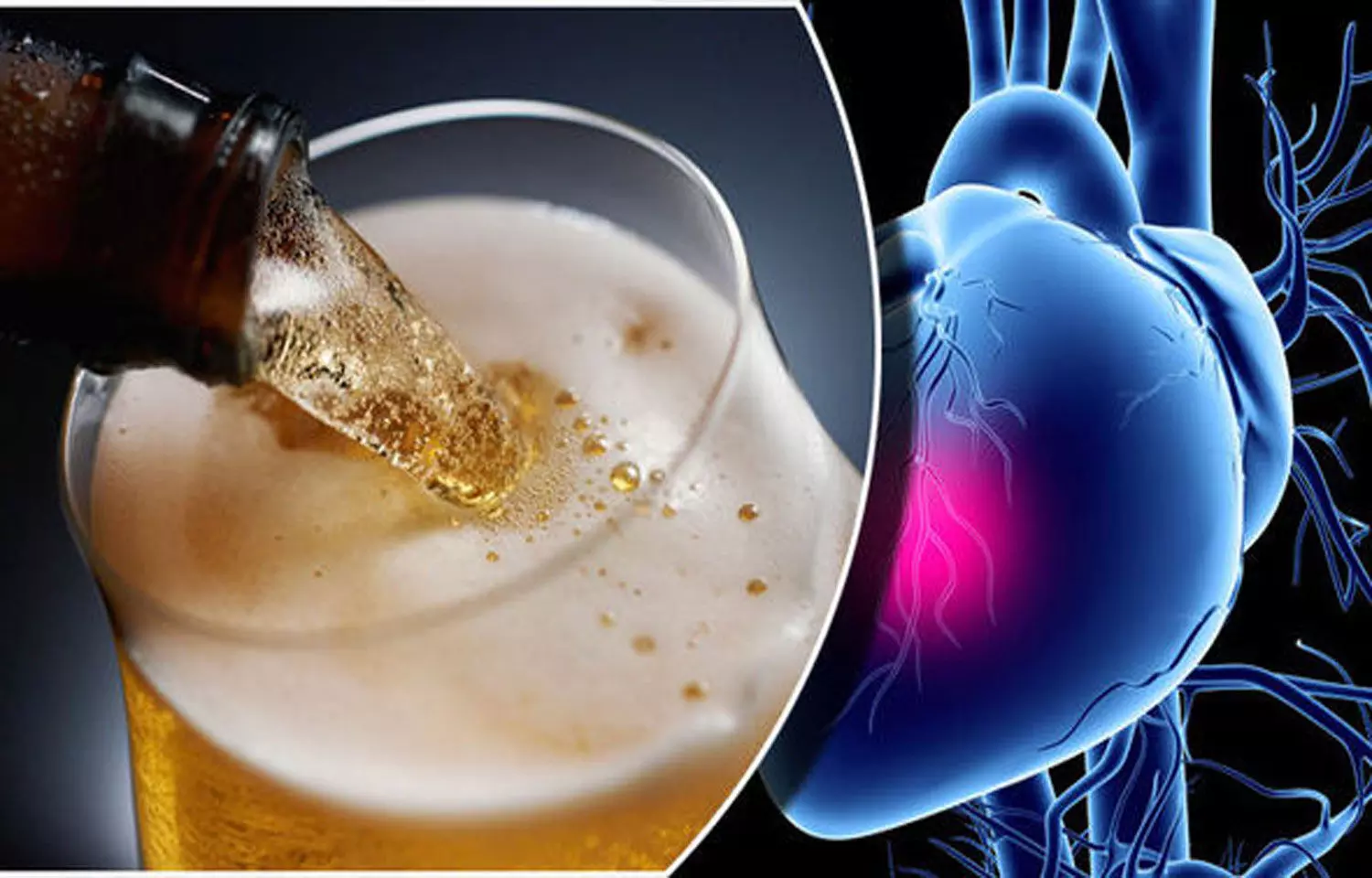 JAMA study refutes the claim that Light alcohol consumption benefits heart health