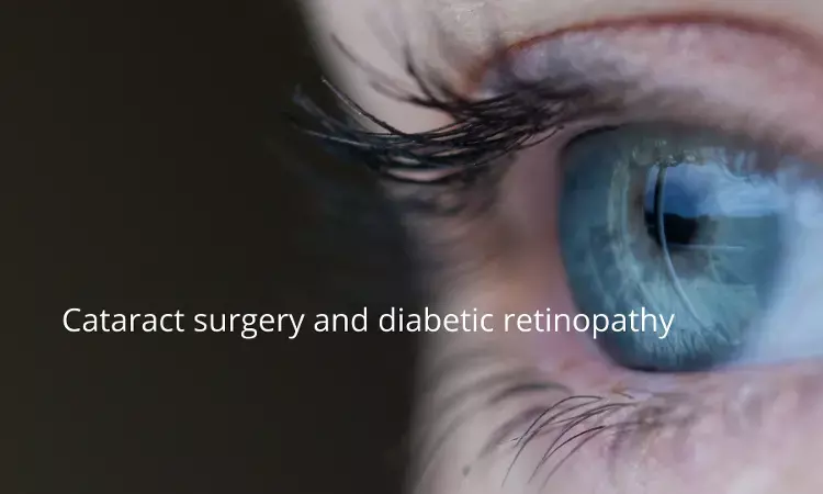 Prior cataract surgery tied with higher risk of developing Diabetic Retinopathy among patients: JAMA