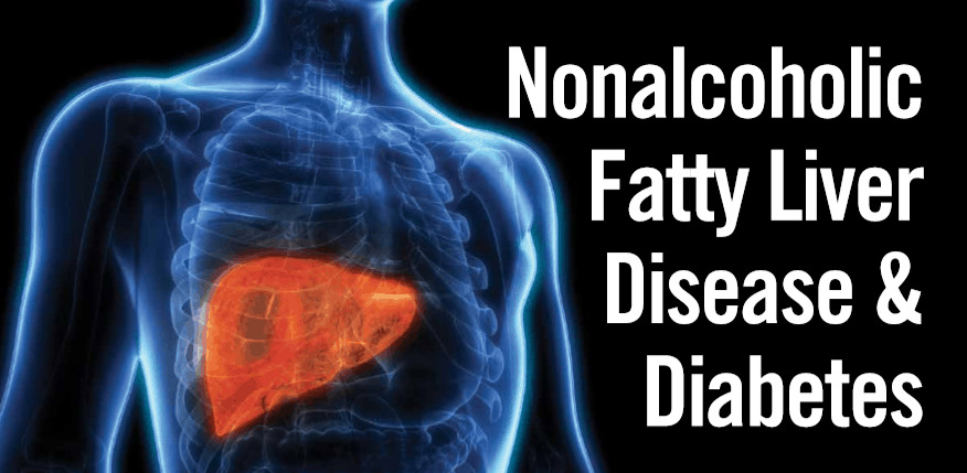 Non alcoholic fatty liver disease. Non-alcoholic fatty Liver disease and risk of cardiovascular disease and Type 2 Diabetes:.