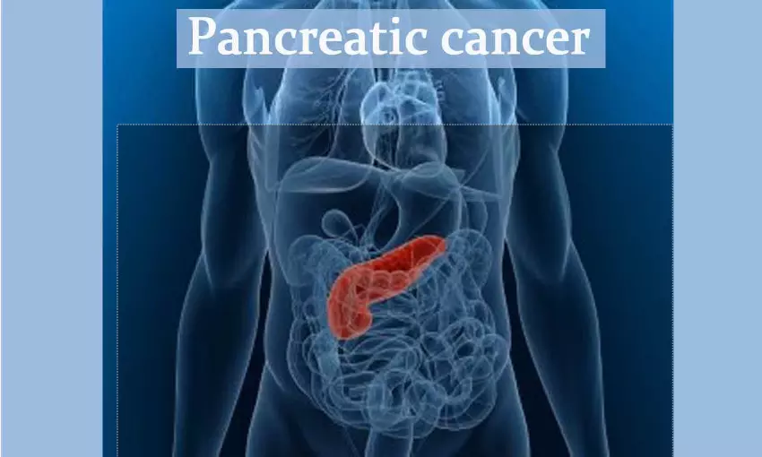 Study uncovers link between inflammation and pancreatic cancer development
