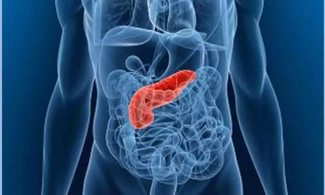 Ketogenic diet may enhance  chemotherapy in pancreatic cancer