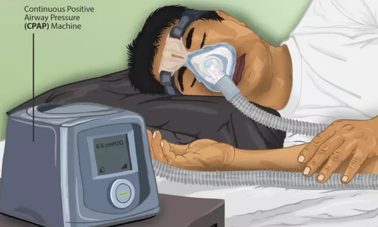 Obstructive sleep apnea tied with increased risk of CVD: Study