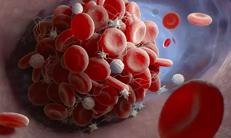 Abelacimab effectively prevents postoperative venous thromboembolism: NEJM