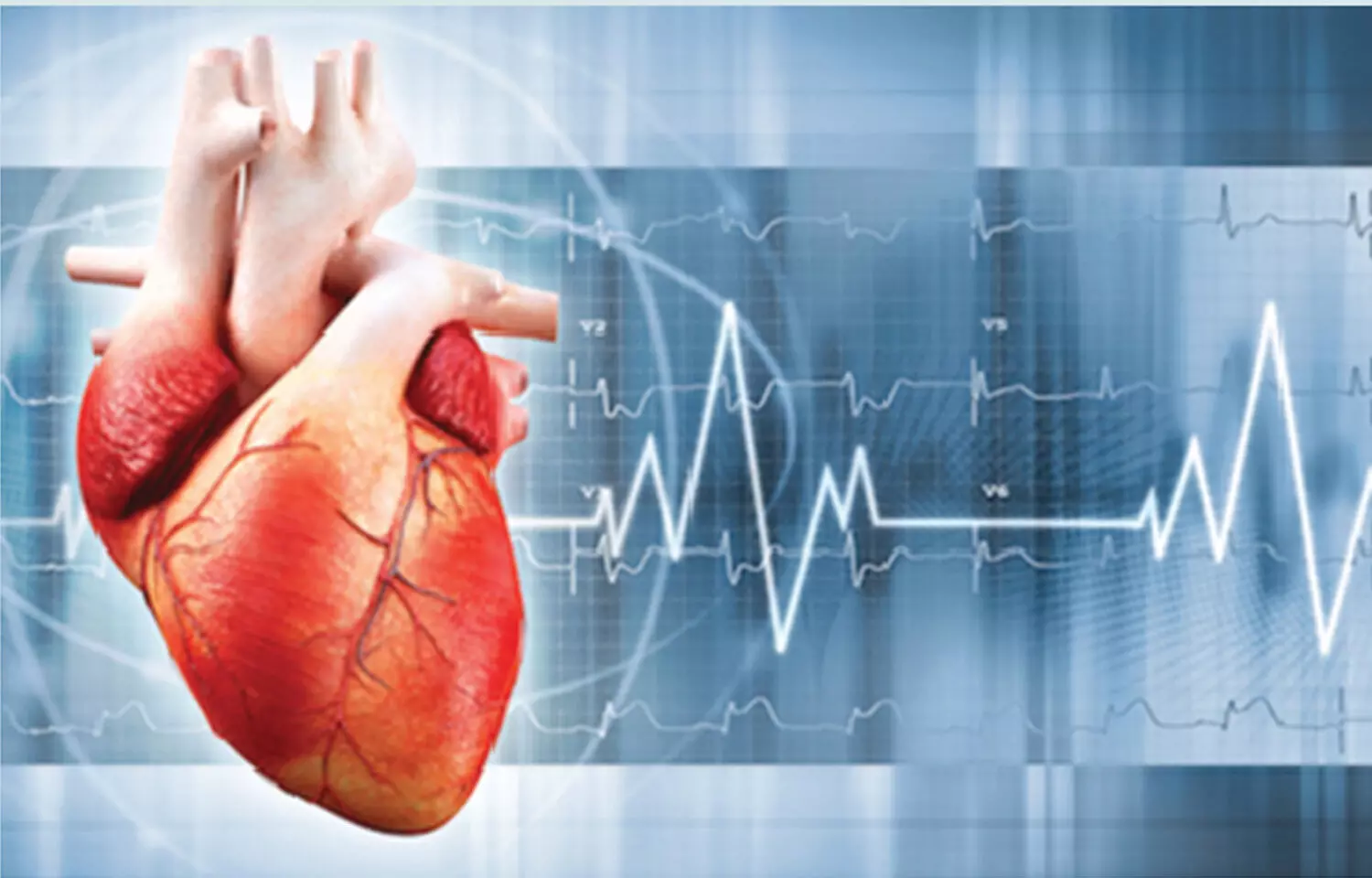 Milrinone no better than dobutamine for treatment of cardiogenic shock: NEJM