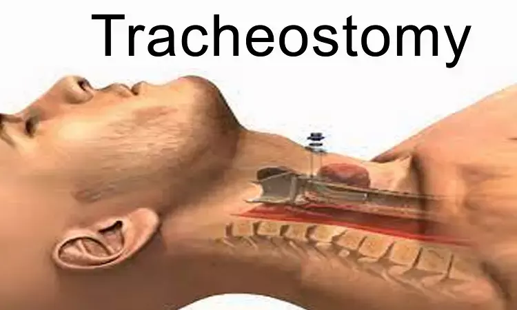 Better tracheostomy technique- Bjork flap or tracheal window?