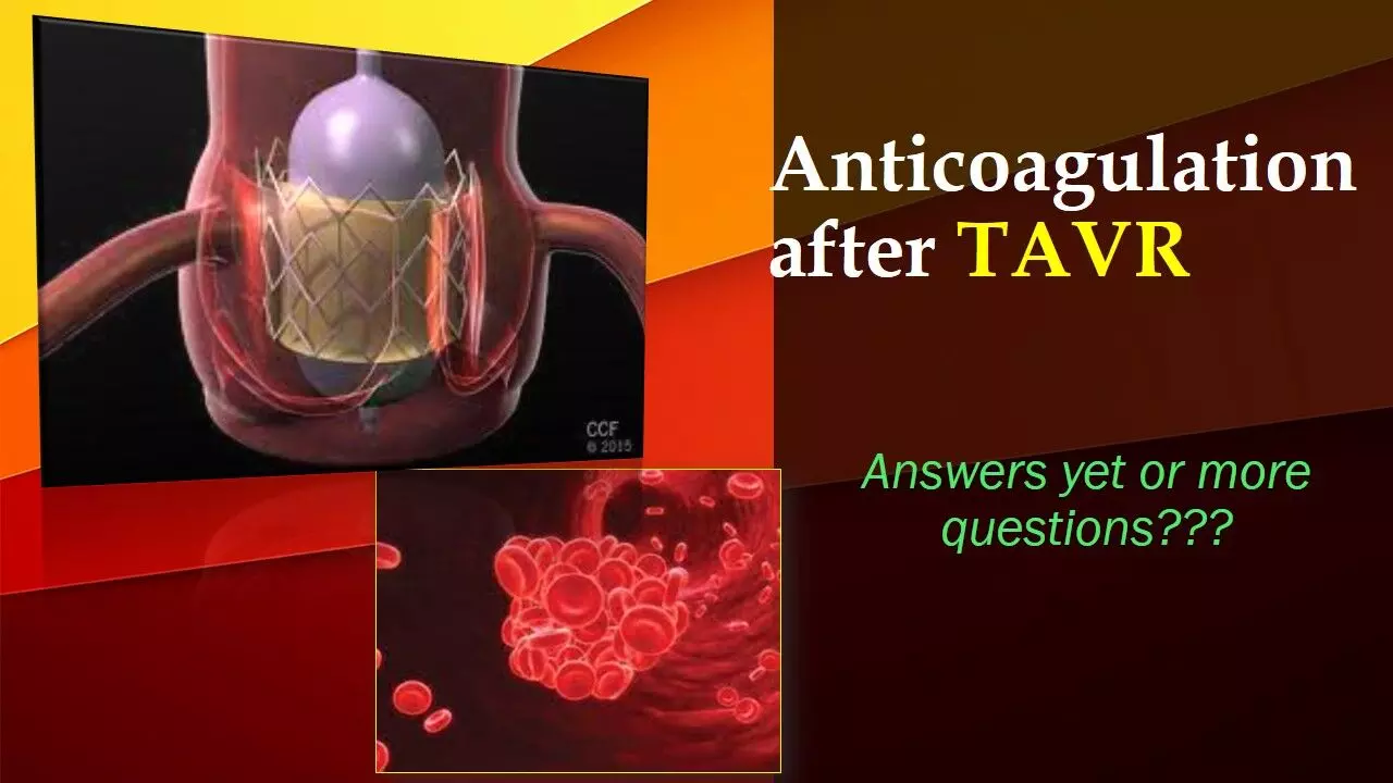 DOACs safer than warfarin analogues for TAVR patients, JACC study.