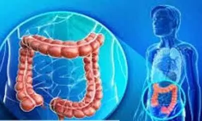 Radical Surgery beneficial in metastatic Colorectal Cancer: IJS study
