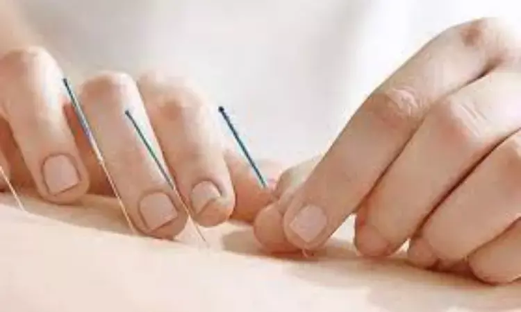 Acupuncture reduces pain and opioid use for total knee replacement surgery patients