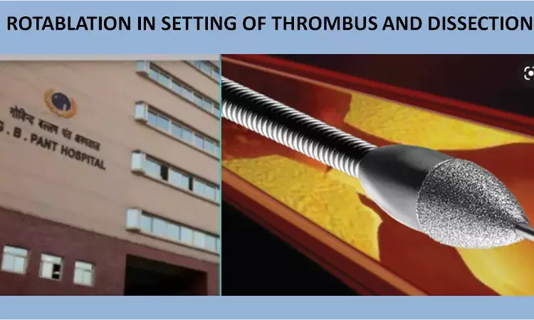 Rotablation in presence of thrombus and dissection: a case report