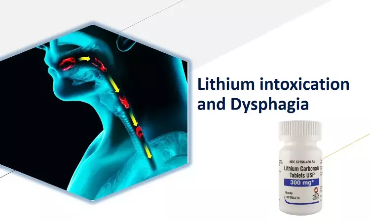 Lithium toxicity may cause Oropharyngeal Dysphagia, a case report.